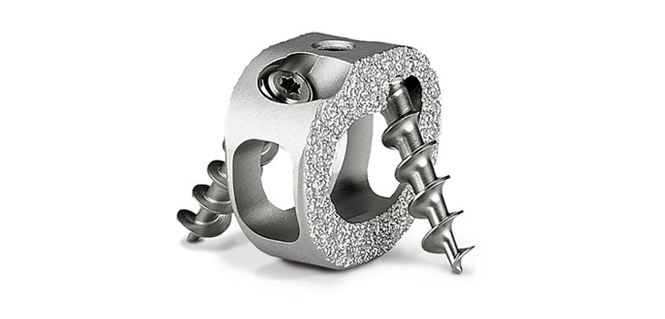 Titan Spine: 510(k) for Endoskeleton TCS
