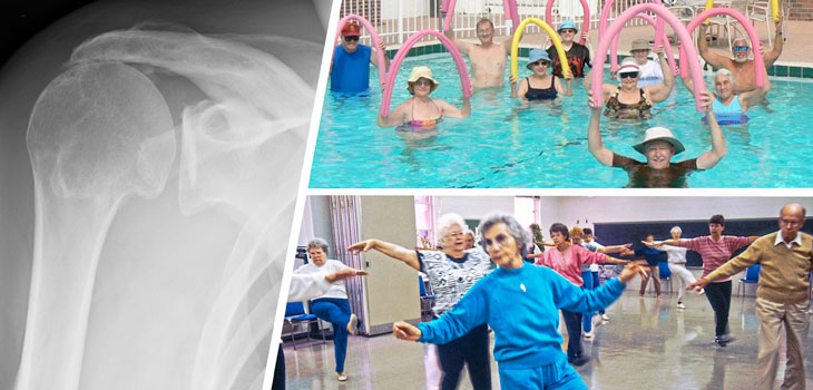 Surprising Data on Elderly Shoulder Surgery Outcomes // Retain BOTH Cruciates and Have a Natural Feeling? // and More!