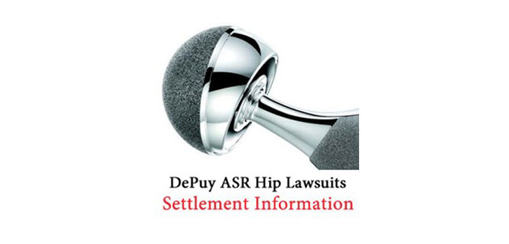 DePuy Hip Settlements Could Top $4 Billion