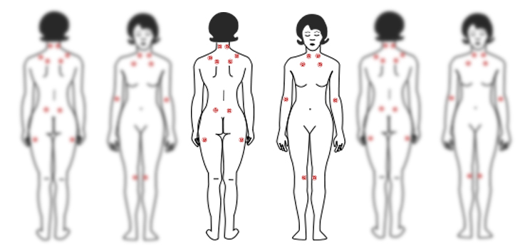 Study Questions Arthroplasty for Fibromyalgia Patients