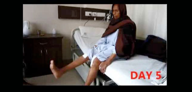 India Doc Corrects 90° Deformity