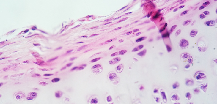 Cartilage Yields Secrets to Japanese Researchers