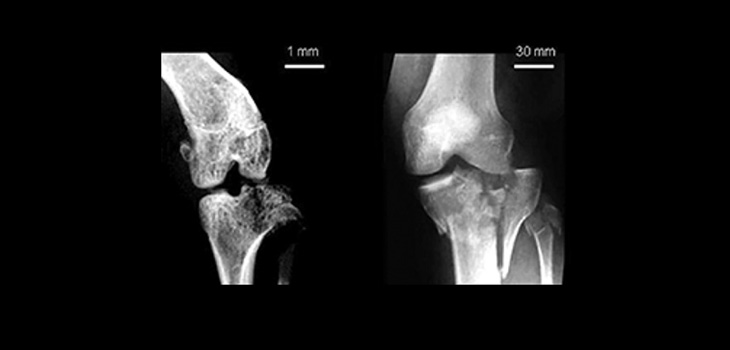AAOS Award Winning Paper Presented Stunning Conclusion