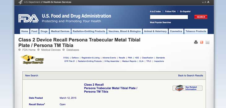 Zimmer Recalls 11, 658 Persona Knee Parts