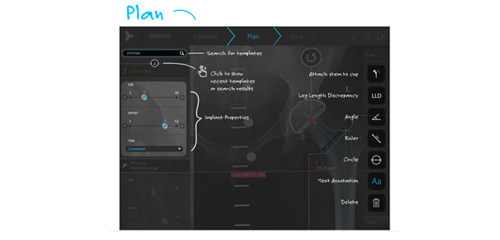 Plan Surgery at Home on iPad App