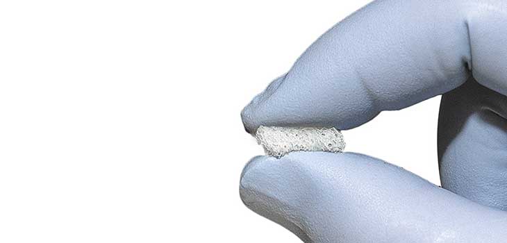 Bacterin Gets Patent for OsteoSponge