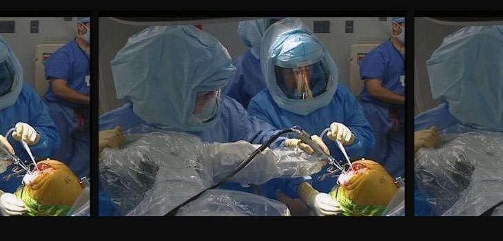 Posttraumatic TKA Can Have Bad Outcomes