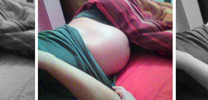 Getting Pregnant After Pro-Disc