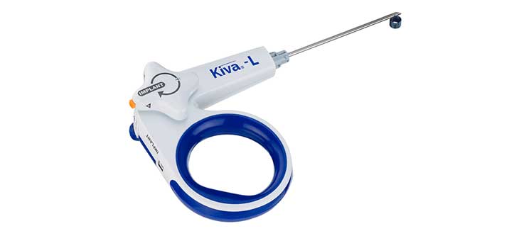 Benvenue Medical Signs Kiva Agreement With Novation