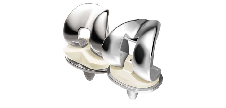 DePuy Issues Safety Notice for LCS Knee System