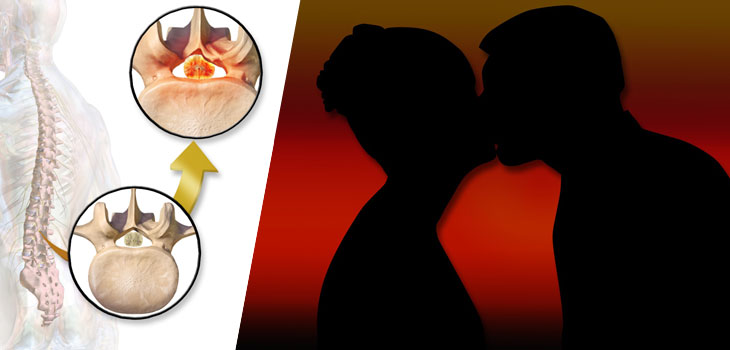 Sex and Low Back Pain: Yes, It Matters