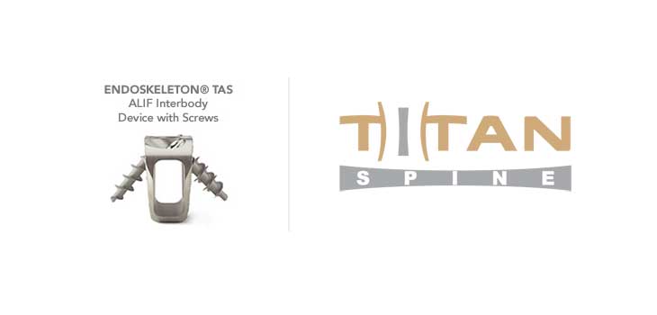 Titan Spine: Our Interbody Devices Trump PEEK Devices