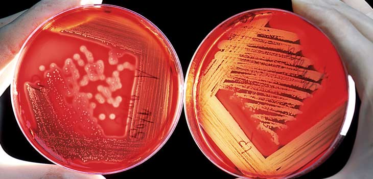 Patent Awarded New Anti-Infection Technology