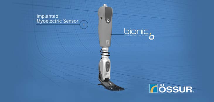Amputees Controlling Bionic Legs With Their Thoughts