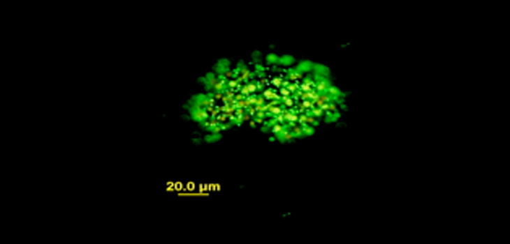 Green Dye Kills Bacteria on Bone