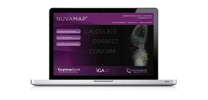 NuVasive Launches Integrated Global Alignment