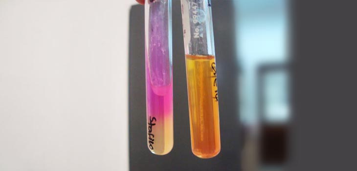 New Study Launched to Test Stem Cells for Knee Pain