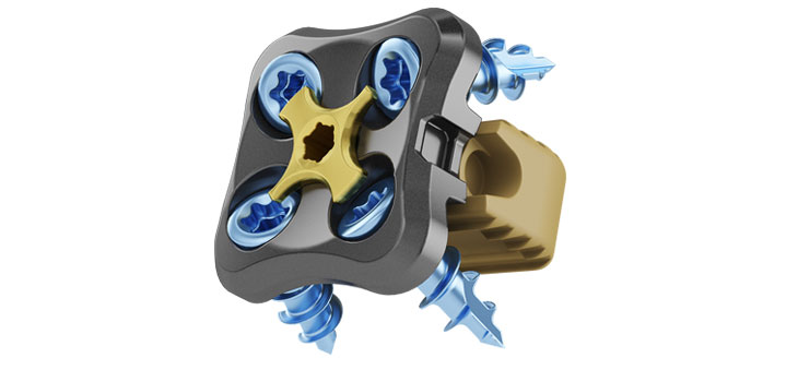Medtronic Picks AANS Meeting for Spine Product Announcements