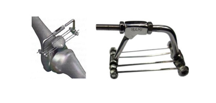 Wardak’s Afghan Device Study Published