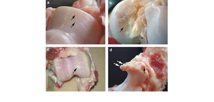 Cytokine Identified as Factor in Cartilage Damage