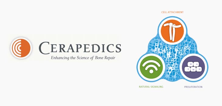 No FDA Panel Required for Cerapedics PMA Application