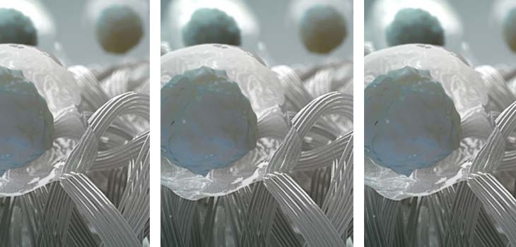 Anika Therapeutics: Positive Results for Knee OA Therapy