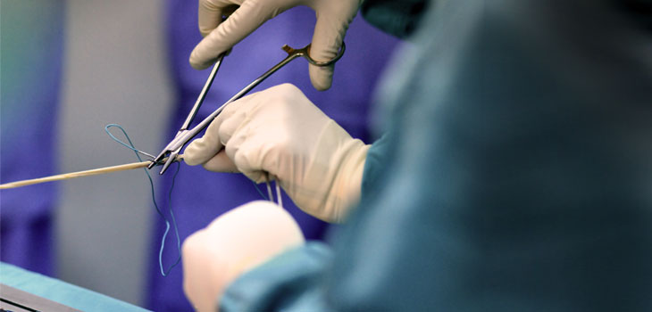 BTB Grafts: No Faster Healing Than Hamstring Grafts