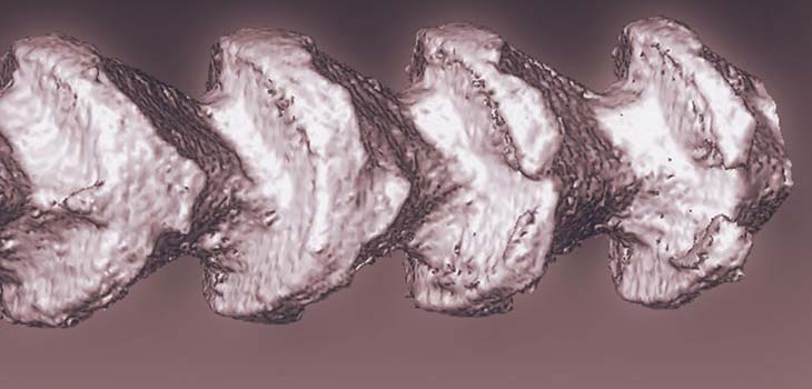Silicon for Tissue Regeneration?