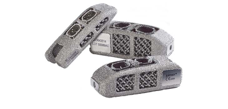 FDA Clears joimax’s Endoscopic-Assisted Fusion Cage