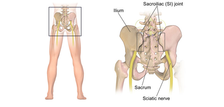 Three New Studies: CT Scans Uncover Widespread SI Joint Degeneration // Distressed Patients Mean Dissatisfaction With Surgeon // and More!