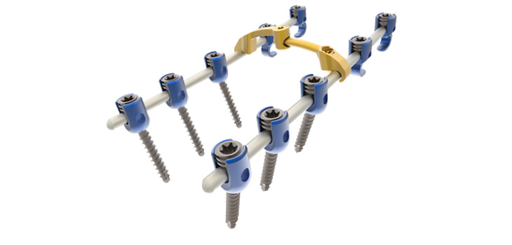 ChoiceSpine Launches Posterior Cervical System
