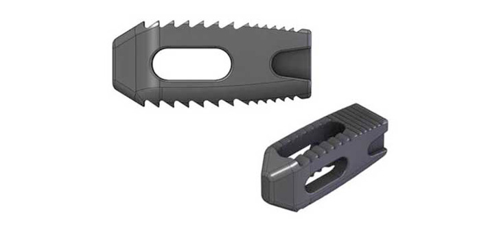 Outlook Improves for Amedica’s Novel Spinal Implant