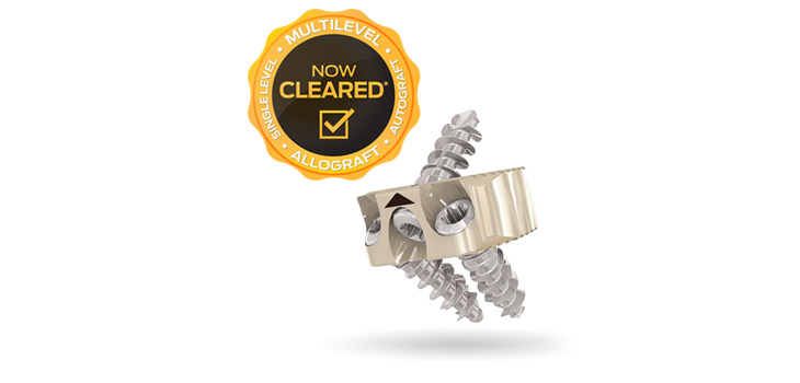Centinel Spine Receives First Cervical Multilevel Clearance