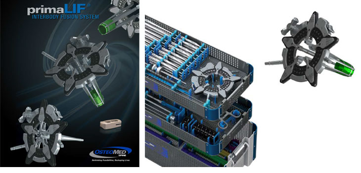 OsteoMed Turns Lateral Access Inside Out