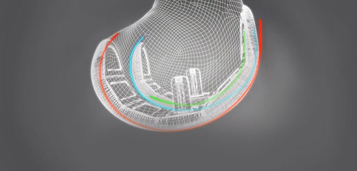ConforMIS iTotal CR Knee Scores in Research Arena