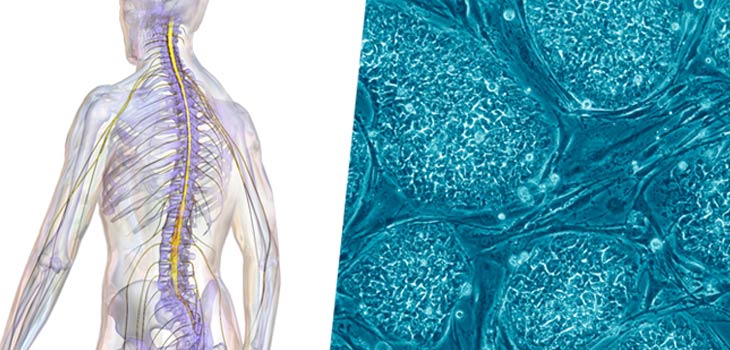 New Stem Cell Therapy for Spinal Cord Injuries