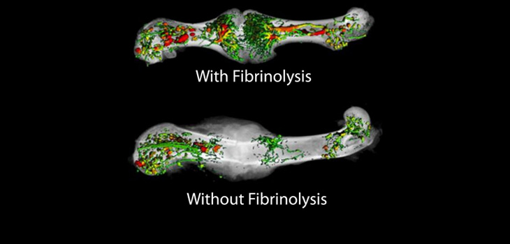 Fibrin Not Necessary for Fracture Healing?!