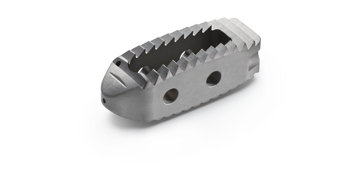SeaSpine Sets Sail With Intervertebral Body Fusion Device