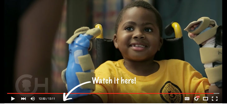 Breathtaking: World’s First Bilateral Hand Transplant in a Child// Nonunion Rate in Subtalar Fusions…Mysteries Remain // and More!