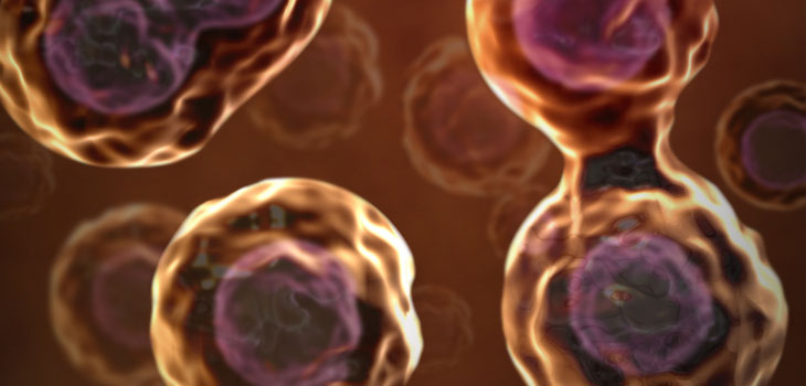 Stem-Cell Treatment for DDD Enters Phase 3