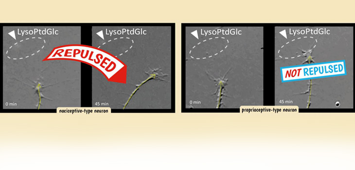 Healing Spinal Cord Damage: Another Piece of the Puzzle