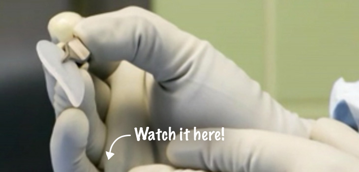 First-in-Ohio: Tissue From Patient’s Cells Used for Knee Cartilage Tx