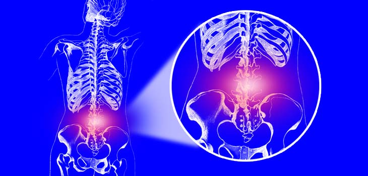 Patients Choose Pain Relief Over Mobility!