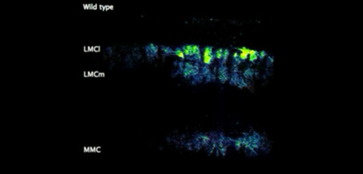 Watch Neurons Walk! Hope for Spinal Cord Injury?
