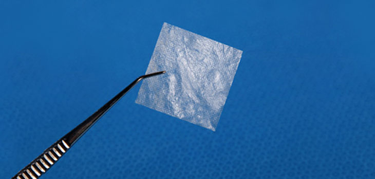 Amniotic Tissue Heals Knee Wound