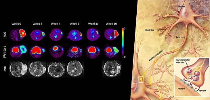 Opiates Receptors Increase to Battle Arthritis
