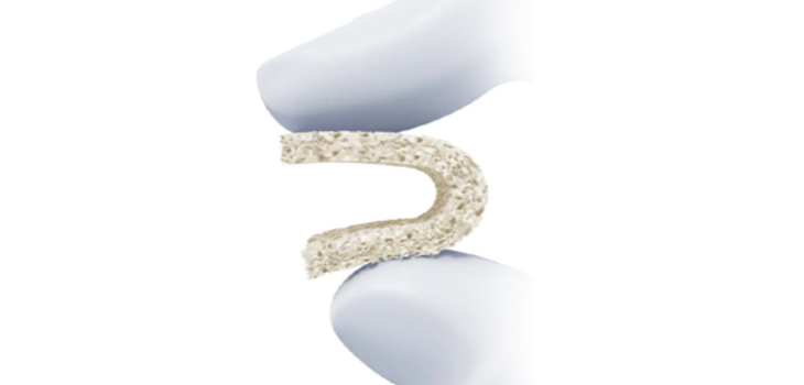 New Extremities Bone Matrix From DePuy Synthes