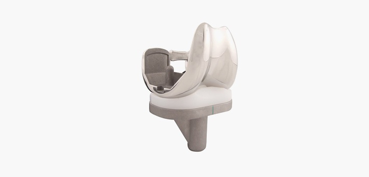 Knee Implant for Asian Bodies