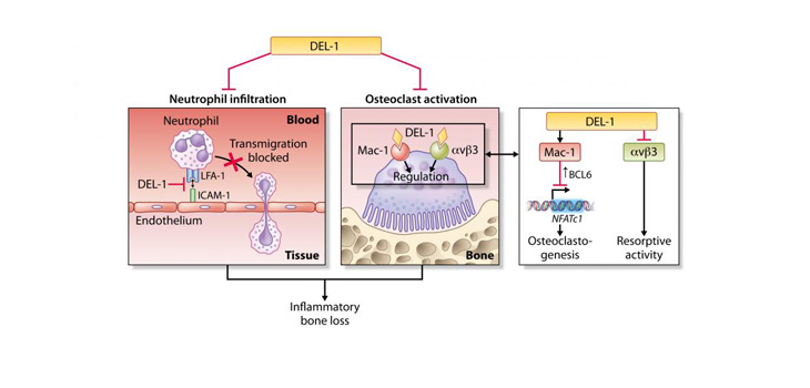 Penn Dental Blocks Bone Loss…Implications for Osteoporosis, RA