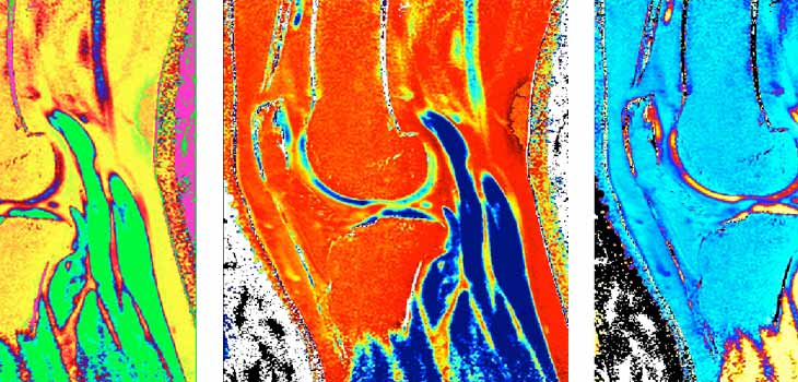 How Motion Causes Cartilage to Resorb Leaking Liquid